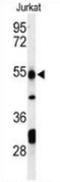 Prune Exopolyphosphatase 1 antibody, AP53474PU-N, Origene, Western Blot image 