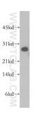 Synaptosome Associated Protein 29 antibody, 12704-1-AP, Proteintech Group, Western Blot image 