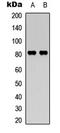 Calpain 11 antibody, LS-C358928, Lifespan Biosciences, Western Blot image 