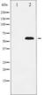 SRY-Box 9 antibody, TA325869, Origene, Western Blot image 