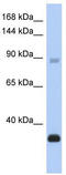 BAF Chromatin Remodeling Complex Subunit BCL11B antibody, TA333697, Origene, Western Blot image 