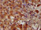 Phosphofurin Acidic Cluster Sorting Protein 2 antibody, LS-C671501, Lifespan Biosciences, Immunohistochemistry paraffin image 