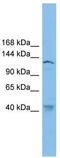 Bamacan antibody, TA342434, Origene, Western Blot image 