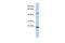 SSX Family Member 4B antibody, PA5-41117, Invitrogen Antibodies, Western Blot image 