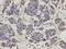 Ring Finger Protein 2 antibody, A01209-2, Boster Biological Technology, Immunohistochemistry paraffin image 
