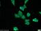 Myocardin Related Transcription Factor A antibody, 21166-1-AP, Proteintech Group, Immunofluorescence image 