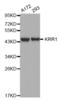 KRR1 Small Subunit Processome Component Homolog antibody, abx003358, Abbexa, Western Blot image 