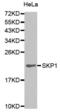 S-Phase Kinase Associated Protein 1 antibody, abx000757, Abbexa, Western Blot image 