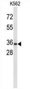 Uroplakin 1A antibody, AP54475PU-N, Origene, Western Blot image 