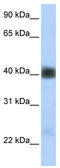 Beta-sarcoglycan antibody, TA334661, Origene, Western Blot image 