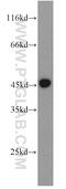 GULP PTB Domain Containing Engulfment Adaptor 1 antibody, 19902-1-AP, Proteintech Group, Western Blot image 