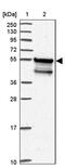 Sphingosine-1-Phosphate Phosphatase 1 antibody, PA5-62741, Invitrogen Antibodies, Western Blot image 