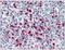 S100 Calcium Binding Protein A8 antibody, AM31838FC-N, Origene, Immunohistochemistry frozen image 