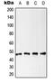 Keratin 18 antibody, MBS821127, MyBioSource, Western Blot image 