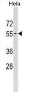GPI mannosyltransferase 3 antibody, abx031401, Abbexa, Western Blot image 