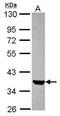 Histone Deacetylase 11 antibody, PA5-30703, Invitrogen Antibodies, Western Blot image 