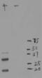 mCherry Tag  antibody, LS-C204827, Lifespan Biosciences, Western Blot image 
