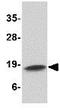 Cathelicidin Antimicrobial Peptide antibody, GTX85418, GeneTex, Western Blot image 