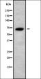 ATP Binding Cassette Subfamily A Member 3 antibody, orb338041, Biorbyt, Western Blot image 