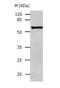 Aldehyde Dehydrogenase 1 Family Member A1 antibody, TA321182, Origene, Western Blot image 