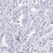 Myosin Light Chain Kinase 2 antibody, NBP2-32489, Novus Biologicals, Immunohistochemistry frozen image 