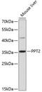 Palmitoyl-Protein Thioesterase 2 antibody, 14-335, ProSci, Western Blot image 