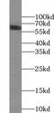 Solute Carrier Family 17 Member 6 antibody, FNab09401, FineTest, Western Blot image 