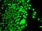Oncostatin M antibody, A00804-2, Boster Biological Technology, Immunohistochemistry paraffin image 