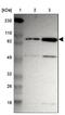 Zinc Finger Protein 267 antibody, NBP1-81633, Novus Biologicals, Western Blot image 