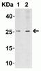 LIF Interleukin 6 Family Cytokine antibody, NBP1-76554, Novus Biologicals, Western Blot image 