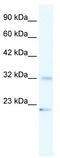 Zinc Finger RANBP2-Type Containing 2 antibody, TA331505, Origene, Western Blot image 
