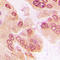 Forkhead Box O1 antibody, LS-C368599, Lifespan Biosciences, Immunohistochemistry frozen image 