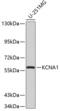 Potassium voltage-gated channel subfamily A member 1 antibody, 18-898, ProSci, Western Blot image 
