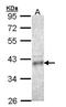 Coproporphyrinogen Oxidase antibody, GTX105056, GeneTex, Western Blot image 