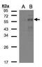Krox-20 antibody, PA5-27814, Invitrogen Antibodies, Western Blot image 
