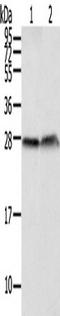 Claudin 19 antibody, TA322029, Origene, Western Blot image 
