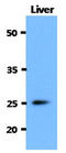 CD152 antibody, AM50045PU-N, Origene, Western Blot image 