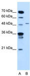 Tyrosinase Related Protein 1 antibody, TA335247, Origene, Western Blot image 