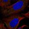Serine/threonine-protein kinase Nek4 antibody, HPA058543, Atlas Antibodies, Immunofluorescence image 