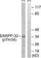 Protein Phosphatase 1 Regulatory Inhibitor Subunit 1B antibody, TA312427, Origene, Western Blot image 