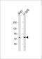 Mannosidase Alpha Class 1A Member 2 antibody, 61-241, ProSci, Western Blot image 
