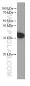 CD99 Molecule (Xg Blood Group) antibody, 60354-1-Ig, Proteintech Group, Enzyme Linked Immunosorbent Assay image 