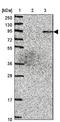 PH Domain And Leucine Rich Repeat Protein Phosphatase 2 antibody, NBP2-13757, Novus Biologicals, Western Blot image 