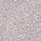 Serine/threonine-protein kinase B-raf antibody, HPA001328, Atlas Antibodies, Immunohistochemistry frozen image 