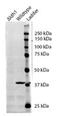 Aldehyde Dehydrogenase 1 Family Member A1 antibody, AP31099PU-N, Origene, Western Blot image 