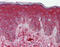 Dcn antibody, ARP48199_P050, Aviva Systems Biology, Immunohistochemistry paraffin image 