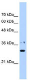 Nicotinamide Nucleotide Adenylyltransferase 1 antibody, TA346819, Origene, Western Blot image 