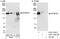 Eukaryotic Translation Initiation Factor 5B antibody, A301-745A, Bethyl Labs, Western Blot image 