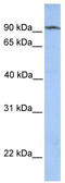 ClpB Homolog, Mitochondrial AAA ATPase Chaperonin antibody, TA335441, Origene, Western Blot image 