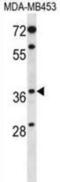 Progestin And AdipoQ Receptor Family Member 8 antibody, abx028355, Abbexa, Western Blot image 